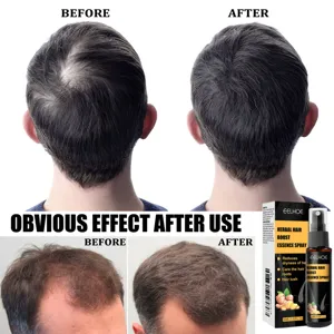 Detail view of herbal hair growth essence spray showing usage comparison and bottle packaging.