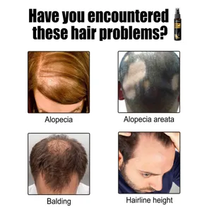 Detail view showing common hair loss problems like alopecia and balding with herbal spray bottle.