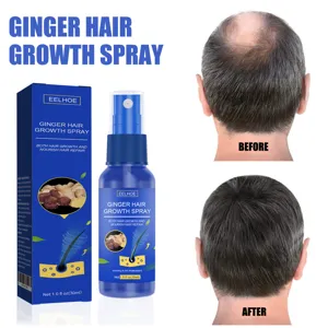 EELHOE Ingwer Haarwachstum Spray Natürliche Kopfhaut Pflege gegen Haarausfall 30ml