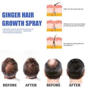 Detailansicht des Ingwer Haarwuchssprays mit Follikel Mechanismus und den Ergebnissen.