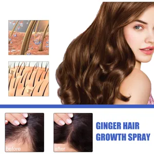 Detailansicht des Ingwer HaarsWachstumssprays mit Kopfhautpflege und Follikelgrafik.