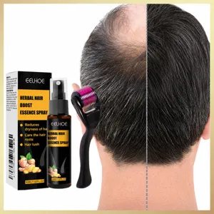 Herbal Hair Growth Essence Spray With Scalp Micro Needle Roller Nourishing Anti Hair Loss Scalp Care Liquid Set