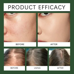 Bille de rouleau d'huile de ricin pour cheveux nourrissants et soin hydratant.
