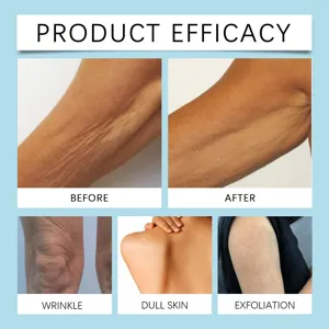 Bee venom body cream efficacy chart showing skin tightening, wrinkle reduction, and moisture.