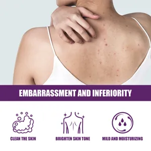 Body exfoliating gel for back acne, promoting clean and brightened skin tone