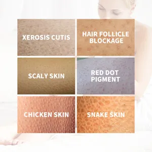 Close-up detail of six common skin conditions including chicken skin and scaly skin