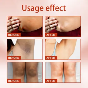 Spray di cura EELHOE per esfoliare la melanina e sbiancare articolazioni e ascelle scure.