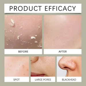 Men facial scrub efficacy detail chart showing before and after skin cleaning results clearly.