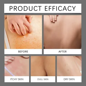 Detail view of body cleansing soap efficacy showing before and after skin conditions.