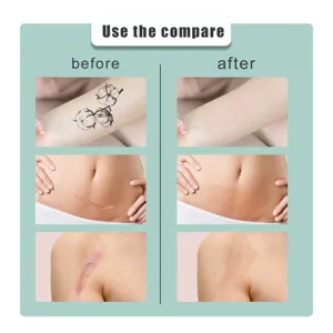 Vista detallada del parche corrector de piel que muestra el antes y después en tatuajes.