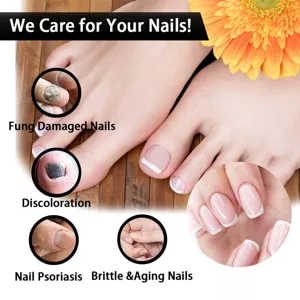 Vue détaillée montrant les problèmes d'ongles, dommages fongiques et soins nécessaires.