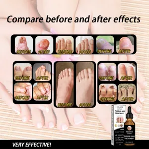 EELHOE Huile de Reparation Traitement des Ongles 30ml nourrit et prend soin des mains.
