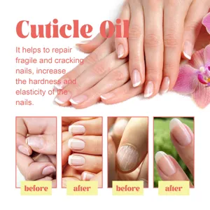 Cuticle oil for repairing fragile cracking nails, increasing hardness and elasticity, 15ml