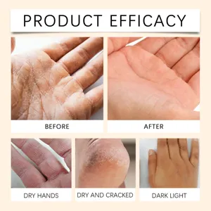 Maschera mani e piedi al miele latte riparazione idratante pelle secca cura quotidiana