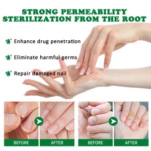 Gedetailleerd overzicht van nagelverzorgingsvloeistof met sterke permeabiliteit en herstel.