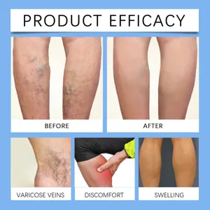 Detail view of product efficacy showing before and after comparison for leg vein comfort.