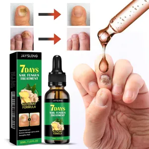 Jaysuing nagelschimmel behandeling serum 30ml, kruidenformule voor hand- en teennagelverzorging.