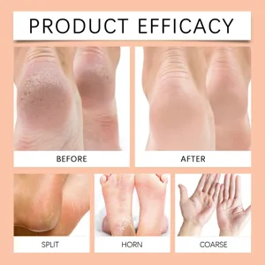 Crema cuidado manos y pies comparación eficacia muestra resultados piel suave transformados.