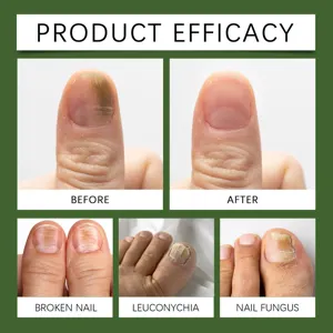 Detail view of nail repair product efficacy, showing before and after treatment close-ups.