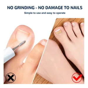 Parches de Corrección de Uñas de los Pies Tratamiento de Uñas Encarnadas Cuidado Profesional de los Pies Herramientas de Reparación de Uñas Pegatinas Elásticas Nude