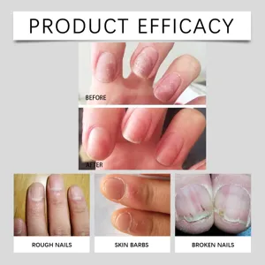 Nail care oil efficacy display chart showing before and after treatment results for rough and damaged nails.
