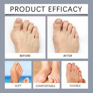 Detailed view showing foot care product efficacy, soft and comfortable toe corrector design.