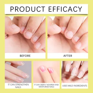 Nail care pen detail view showing before and after treatment, nourishing dry cuticles effectively.