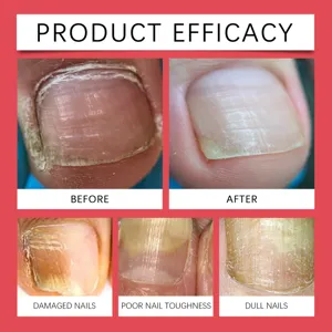 Gedetailleerd overzicht van de nagelverzorgingseffectiviteit met verbeterde nagelgezondheid.