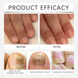 Nail care liquid treatment set for repairing damaged nails and nourishing nail cuticles effectively.