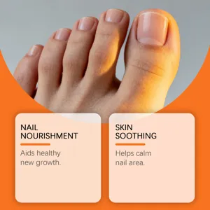 Close-up detail of neat toenails with care text, perfect for nail health showcase.