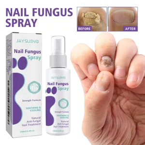 Jaysuing Nail Fungus Spray 100ml Anti Fungal Nail Treatment Care Liquid for Hands and Toes