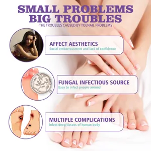 Detail view showing nail fungal infection pain points and foot care concept for health.