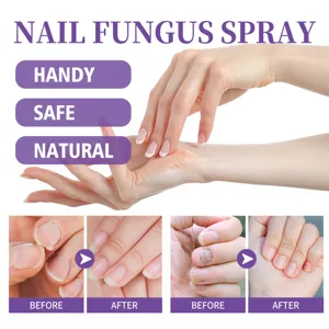 Jaysuing Nail Fungus Spray Foot and Hand Care Anti Fungal Treatment Repair Liquid Soothing Cooling Formula