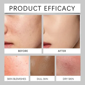 Product efficacy detail showing skin condition comparison before and after using men concealer.