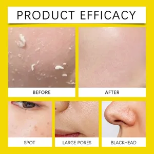 Skin efficacy detail showing pore cleaning, spot reduction, and blackhead removal results clearly.