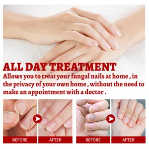 Nail care oil detail view showing effective daily moisturizing and treatment results for nails.