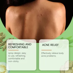 Salicylzuur lichaam kruidenspray detail, verfrissend en comfortabel voor acne behandeling.