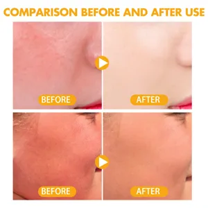 Détail montrant l'effet sur la peau avant et après l'application de la poudre protectrice.