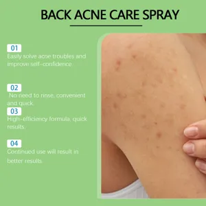 Salicylzuur Kruidenlichaamsspray detailweergave voor effectieve acneverzorging en huid.
