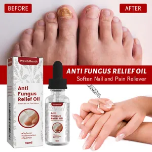 WEST MONTH anti fungus nail relief oil 10ml, soften and care for healthy toenails and fingers.