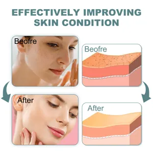 Retinol Gesichtscreme verbessert Hautzustand effektiv, spendet Feuchtigkeit und mindert Falten.