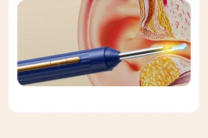 Vue détaillée de l'otoscope visuel intelligent avec embout lumineux dans le canal auriculaire.
