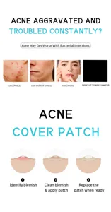 Vista dettagliata che mostra i benefici del cerotto anti-acne e la guida in 3 passaggi.