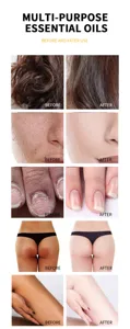 Huile essentielle polyvalente pour soin cheveux visage ongle corps avant après résultat détail.
