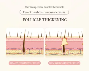 Illustrazione dettagliata dei follicoli piliferi per crema depilatoria delicata e cura efficace.