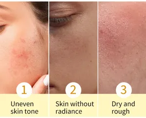 Close-up skin detail chart showing uneven tone, dullness, and dry rough texture for skincare.