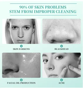 Banniere informative sur les problemes de peau du visage et l'acne pour les soins de la peau.
