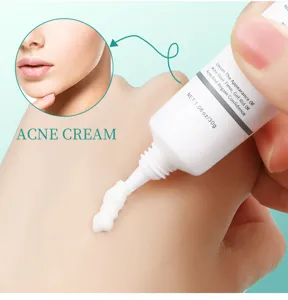 Detail de texture de creme anti-acne sur la main avec application de soin du visage.
