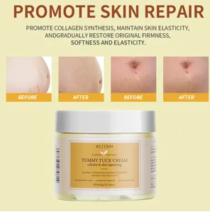MEJISOO Tummy Tuck Cream stretch mark repair 150g postpartum skin tightening and firming lotion.
