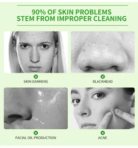 Skincare infographic showing skin problems caused by improper cleaning like blackheads and acne.